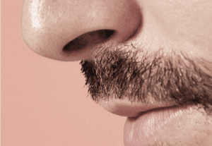 Rhinoplasty Dubai