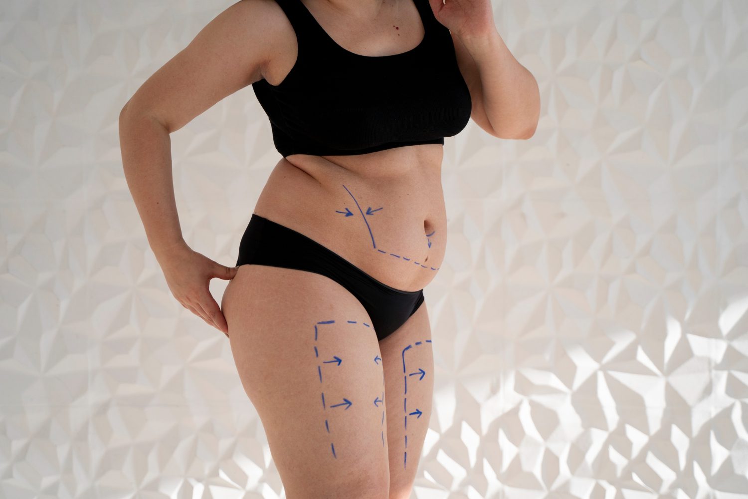 FaceTite & BodyTite: Advanced, Non-Surgical Contouring Solutions