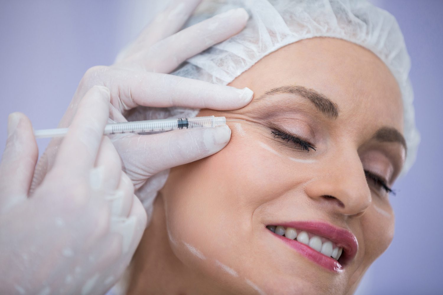 Botox Dubai